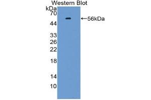 Image no. 1 for anti-Kruppel-Like Factor 10 (KLF10) (AA 1-210) antibody (ABIN2914257)
