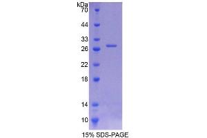 Image no. 1 for Intersectin 1 (ITSN1) (AA 1-227) protein (His tag) (ABIN6238711)
