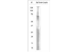 Image no. 10 for anti-Solute Carrier Family 18 (Vesicular Acetylcholine), Member 3 (SLC18A3) (C-Term) antibody (ABIN571640)