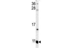 Image no. 5 for anti-S100 Calcium Binding Protein A6 (S100A6) (AA 37-67) antibody (ABIN3032513)