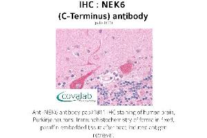 Image no. 1 for anti-NIMA (Never in Mitosis Gene A)-Related Kinase 6 (NEK6) (C-Term) antibody (ABIN1737251)