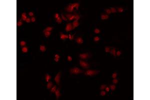 Image no. 3 for anti-Protein Kinase C, epsilon (PRKCE) (pSer729) antibody (ABIN6255486)