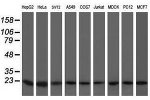 Image no. 6 for anti-Prefoldin Subunit 3 (PFDN3) antibody (ABIN1501705)