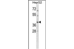 Image no. 1 for anti-DNA Repair Protein RAD51 Homolog 3 (RAD51C) (AA 169-198) antibody (ABIN5537437)