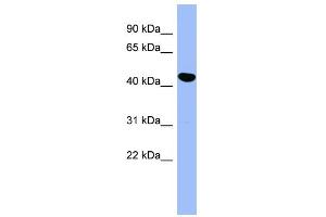 Image no. 1 for anti-serpin Peptidase Inhibitor, Clade E (Nexin, Plasminogen Activator Inhibitor Type 1), Member 2 (SERPINE2) (Middle Region) antibody (ABIN2786838)