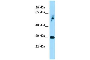 Host:  Rabbit  Target Name:  Prrx1  Sample Type:  Rat Pancreas lysates  Antibody Dilution:  1.