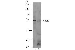 Image no. 4 for anti-serum/glucocorticoid Regulated Kinase 1 (SGK1) (pSer78) antibody (ABIN745688)