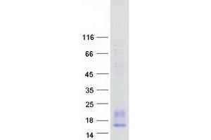 Image no. 1 for Platelet Factor 4 Variant 1 (PF4V1) protein (Myc-DYKDDDDK Tag) (ABIN2728720)