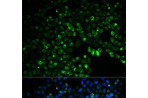 Immunofluorescence analysis of HeLa cells using UGDH Polyclonal Antibody