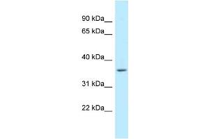 Image no. 1 for anti-Williams Beuren Syndrome Chromosome Region 22 (WBSCR22) (C-Term) antibody (ABIN2789228)