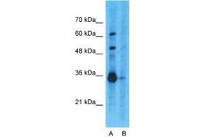 Image no. 3 for anti-Glyceraldehyde-3-Phosphate Dehydrogenase (GAPDH) (N-Term) antibody (ABIN2778645)