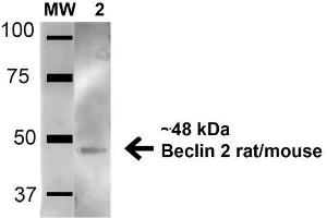 anti-Beclin-1-Like Protein 1 (BECN1L1) (AA 410-421) antibody