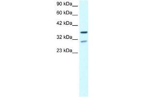 Image no. 2 for anti-Zinc Finger Protein 385A (ZNF385A) (N-Term) antibody (ABIN927393)