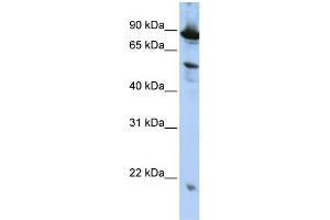 Image no. 2 for anti-Zinc Finger, CCCH-Type with G Patch Domain (ZGPAT) (N-Term) antibody (ABIN2775532)