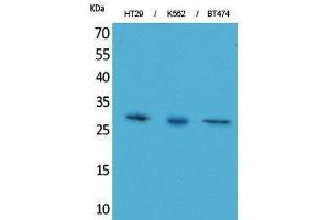 Image no. 1 for anti-Breast Cancer Metastasis-Suppressor 1-Like (BRMS1L) (C-Term) antibody (ABIN3187701)