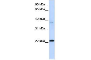 Image no. 1 for anti-Chromosome 11 Open Reading Frame 74 (C11ORF74) (Middle Region) antibody (ABIN632721)