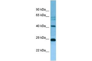Image no. 1 for anti-Mitochondrial Ribosomal Protein L38 (MRPL38) (C-Term) antibody (ABIN2789156)