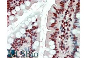 Image no. 4 for anti-Ewing Sarcoma Breakpoint Region 1 (EWSR1) (Internal Region) antibody (ABIN335135)