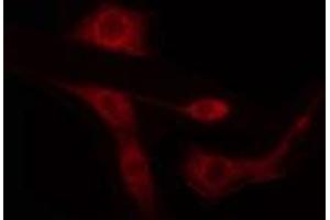 ARID1B antibody  (Internal Region)