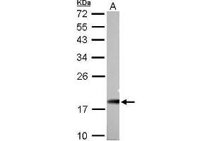 Image no. 4 for anti-NADH Dehydrogenase (Ubiquinone) 1, alpha/beta Subcomplex, 1, 8kDa (NDUFAB1) (C-Term) antibody (ABIN2856829)