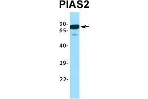 Image no. 5 for anti-Protein Inhibitor of Activated STAT, 2 (PIAS2) (C-Term) antibody (ABIN2776423)