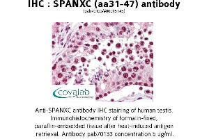 Image no. 1 for anti-SPANX Family, Member C (SPANXC) (AA 31-47) antibody (ABIN1739580)