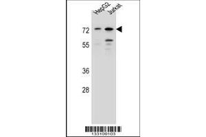 Image no. 1 for anti-Dachshund 2 (DACH2) (AA 145-173), (N-Term) antibody (ABIN657165)