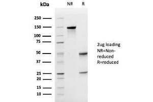 Image no. 1 for anti-Uroplakin 1a (UPK1A) (AA 114-173) antibody (ABIN6939118)