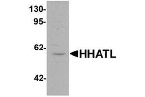 Image no. 2 for anti-Hedgehog Acyltransferase-Like (HHATL) (N-Term) antibody (ABIN1450142)