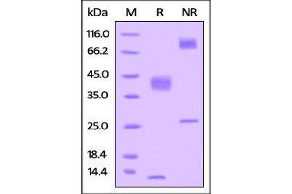 TGFB1 Protein (AA 30-390) (His tag)