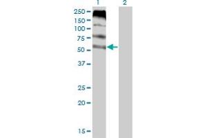 Image no. 3 for anti-Feline Leukemia Virus Subgroup C Cellular Receptor 1 (FLVCR1) (AA 1-83) antibody (ABIN565398)