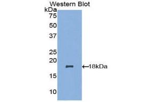 Image no. 1 for anti-NADH Dehydrogenase (Ubiquinone) 1, alpha/beta Subcomplex, 1, 8kDa (NDUFAB1) (AA 3-129) antibody (ABIN1857868)