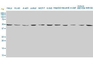 Image no. 2 for anti-Enolase 2 (Gamma, Neuronal) (ENO2) (AA 325-434) antibody (ABIN560742)