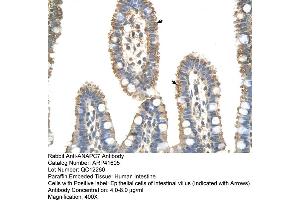 Image no. 2 for anti-Anaphase Promoting Complex Subunit 7 (ANAPC7) (C-Term) antibody (ABIN2776904)