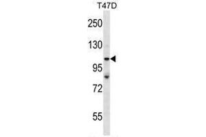 Image no. 1 for anti-Tumor Protein P53 Binding Protein 2 (TP53BP2) (AA 92-122), (N-Term) antibody (ABIN955298)