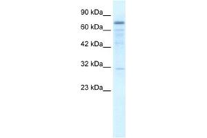 Image no. 1 for anti-tRNA Methyltransferase 1 (TRMT1) (Middle Region) antibody (ABIN2775881)