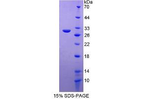 Image no. 1 for Progesterone Immunomodulatory Binding Factor 1 (PIBF1) (AA 13-203) protein (His tag) (ABIN6237654)
