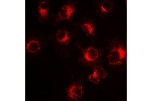 Image no. 2 for anti-Solute Carrier Family 20 (Phosphate Transporter), Member 2 (SLC20A2) antibody (ABIN2966913)
