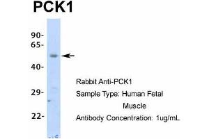 Image no. 1 for anti-phosphoenolpyruvate Carboxykinase 1 (Soluble) (PCK1) (Middle Region) antibody (ABIN2777602)