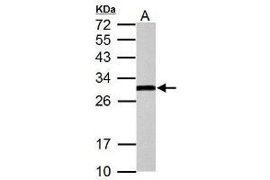 Image no. 7 for anti-Hydroxysteroid (17-Beta) Dehydrogenase 10 (HSD17B10) (C-Term) antibody (ABIN2854703)