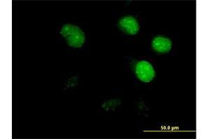 Image no. 3 for anti-Cell Division Cycle Associated 8 (CDCA8) (AA 1-280) antibody (ABIN527374)