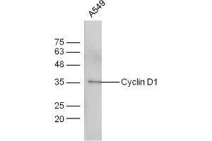 Image no. 4 for anti-Cyclin D1 (CCND1) (AA 61-110) antibody (ABIN671016)