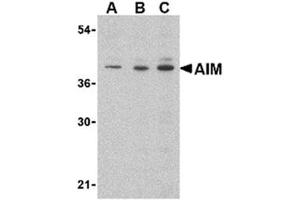 Image no. 1 for anti-CD5 Molecule-Like (CD5L) (C-Term) antibody (ABIN318735)