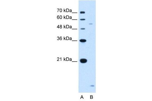 anti-ST3 beta-Galactoside alpha-2,3-Sialyltransferase 5 (ST3GAL5) (N-Term) antibody