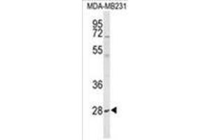 Image no. 1 for anti-Yip1 Domain Family, Member 5 (YIPF5) (AA 28-57), (N-Term) antibody (ABIN955613)