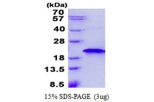 Image no. 1 for Ring Finger Protein 181 (RNF181) protein (His tag) (ABIN1098396)