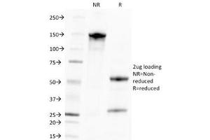 Image no. 1 for anti-Cytomegalovirus (CMV) antibody (ABIN3026155)