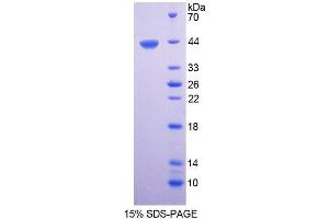 Image no. 1 for Chitobiase, Di-N-Acetyl (CTBS) (AA 47-385) protein (His tag) (ABIN6237246)