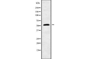 Image no. 1 for anti-RasGEF Domain Family, Member 1A (RASGEF1A) (Internal Region) antibody (ABIN6264647)
