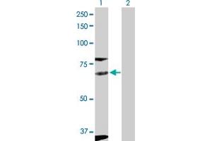 Image no. 2 for anti-FYN Oncogene Related To SRC, FGR, YES (FYN) (AA 1-537) antibody (ABIN515873)